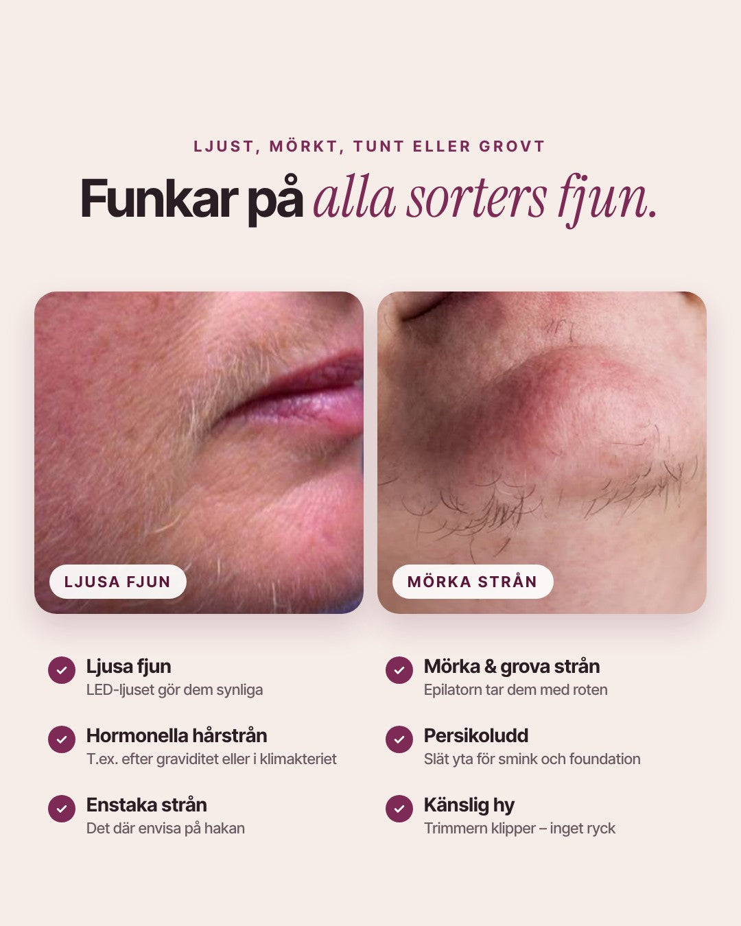 Epilova funkar på ljusa fjun, mörka strån, hormonella hårstrån och persikoludd