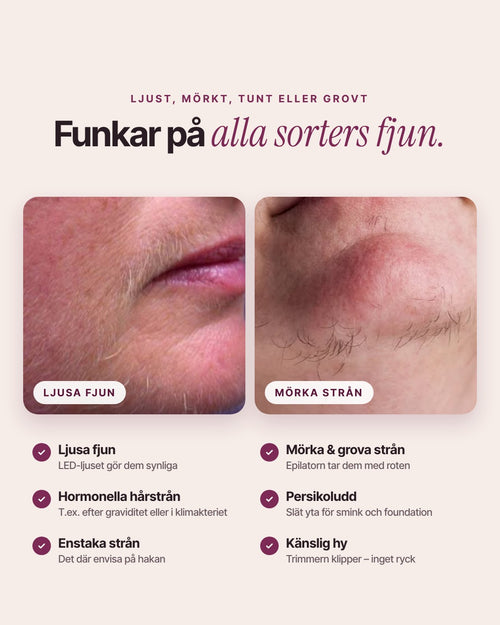 Epilova funkar på ljusa fjun, mörka strån, hormonella hårstrån och persikoludd