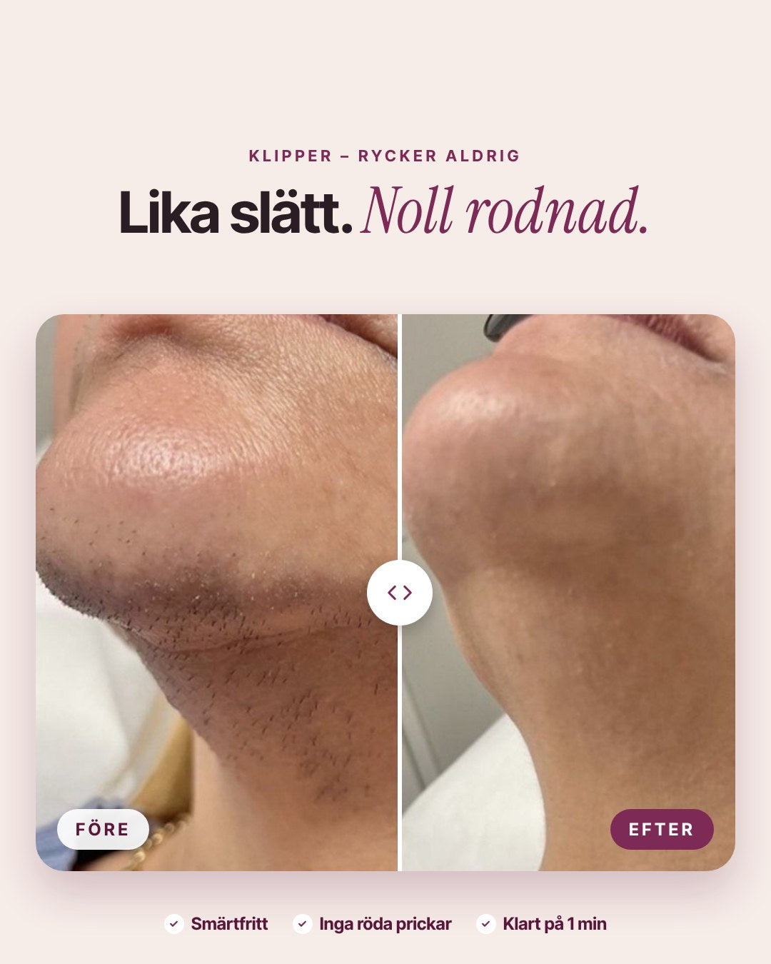 Före och efter – slät haka utan rodnad