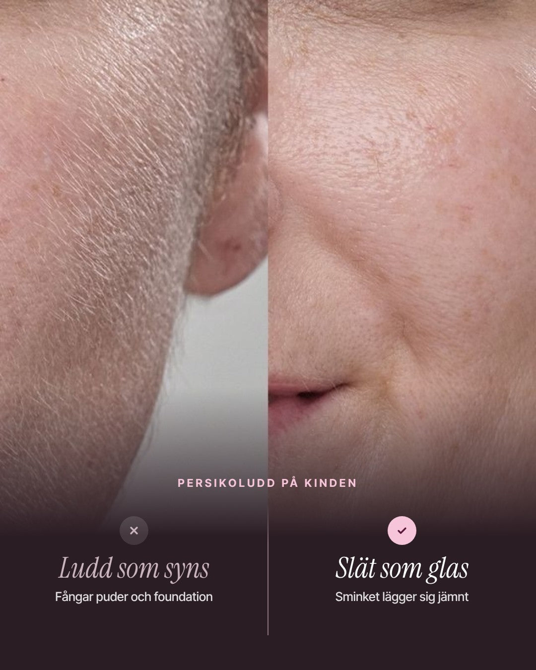 Persikoludd på kinden – före och efter